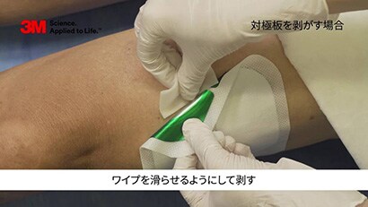 剥離剤と皮膜剤の使い分けによる皮膚トラブル対策動画
