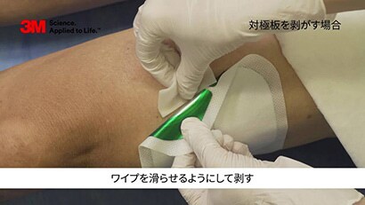 剥離剤と皮膜剤の使い分けによる皮膚トラブル対策

