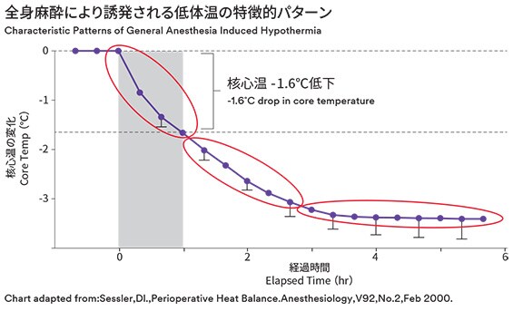 全身麻酔により誘発される低体温の特徴的パターン
