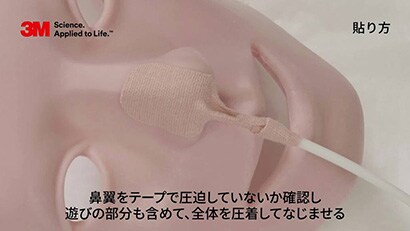 経鼻チューブの固定方法
