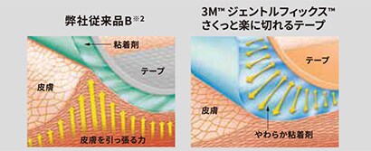 はがす時に痛みが少ない
