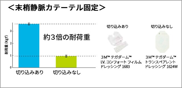末梢静脈カテーテル固定
