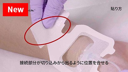 末梢動脈カテーテル（Aライン）の固定３

