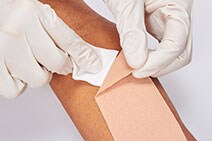 3M™ キャビロン™ 皮膚用リムーバー ワイプタイプ テープ等の粘着製品を剥がす場合の使用イメージ
