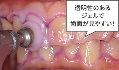 STEP3.
