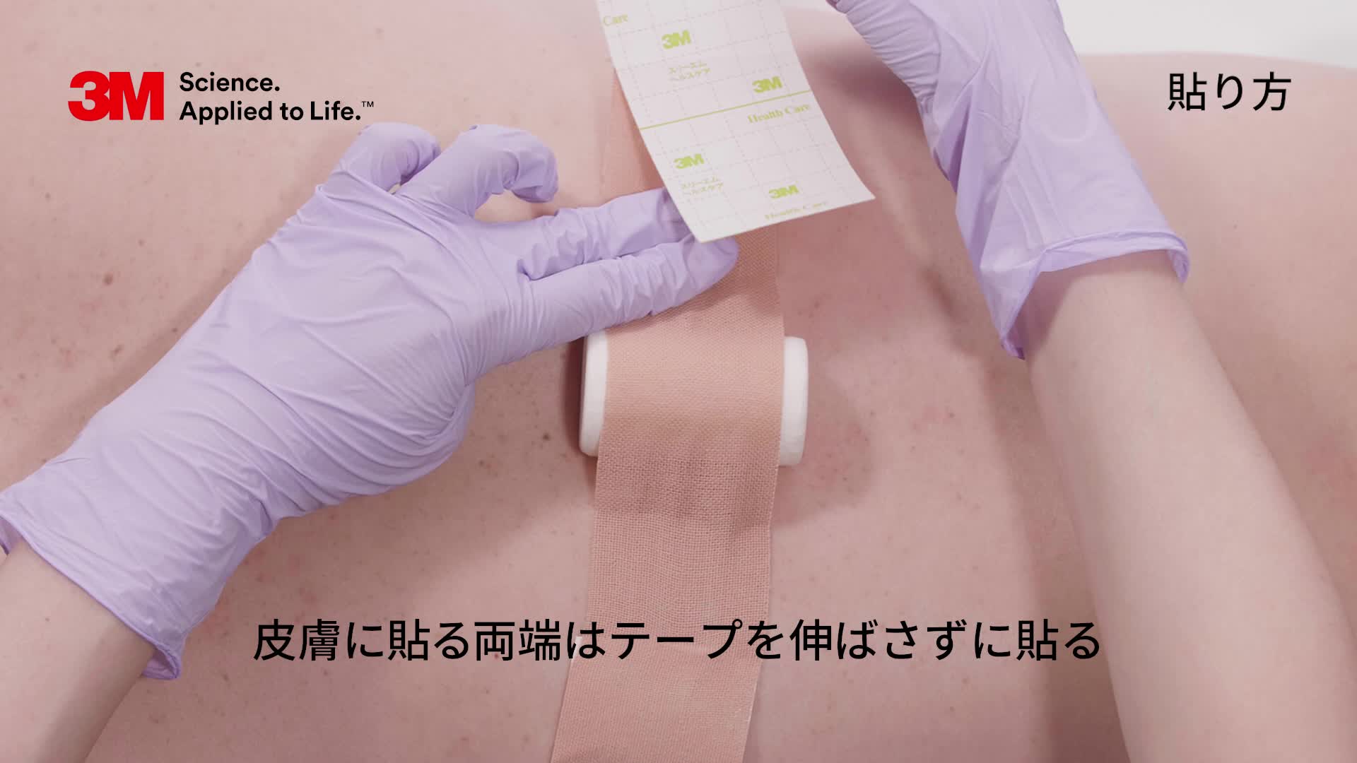 圧迫止血時の固定方法
