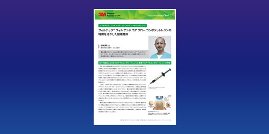 フィルテック™ フィル アンド コア フロー コンポジットレジンの特徴を生かした接着臨床（須崎 明先生　愛知県北名古屋市　ぱんだ歯科）
