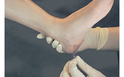 褥瘡対策（ずれ・摩擦対策）などにおける皮膚の被覆に
