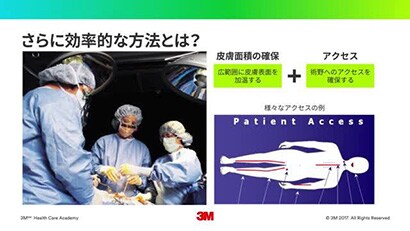 周術期体温管理の基礎知識 ② -効果・効率を考えた加温法-
