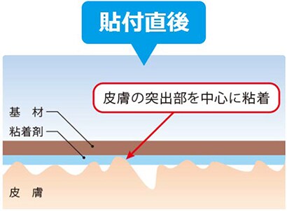 テープ貼付直後
