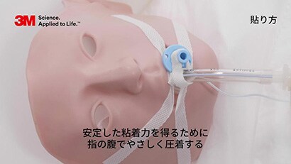 気管内チューブの固定方法２動画
