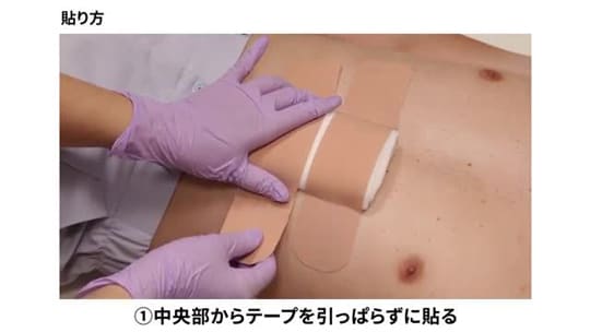 伸縮テープの貼り方・剥がし方
