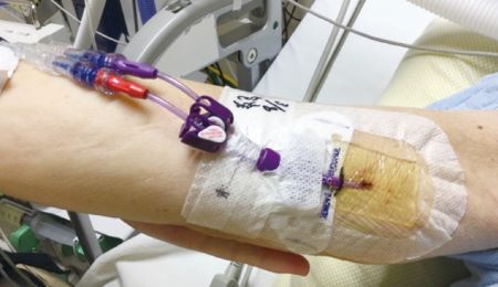 図1　 血管カテーテル刺入部の管理

