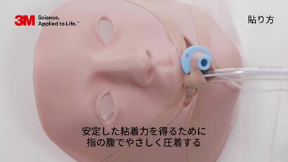 気管内チューブの固定方法
