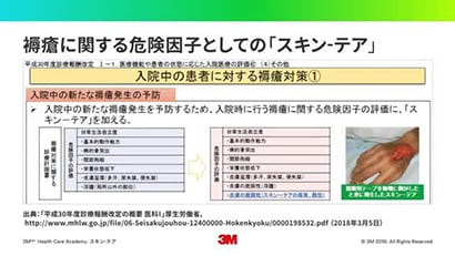 スキン-テアについての動画
