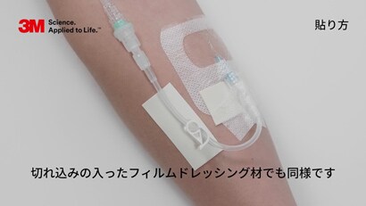 医療関連機器圧迫創傷（MDRPU）対策としての外力低減ケア

