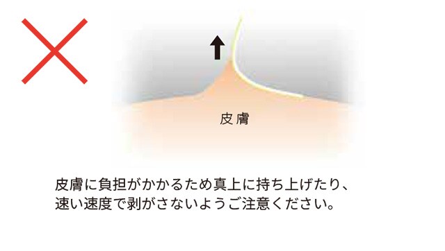 ３Ｍ™ テガダーム™ スムース フィルムロールの正しくない剥がし方
