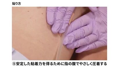 伸縮テープのチューブ固定方法（切り込みを入れたΩ固定）動画
