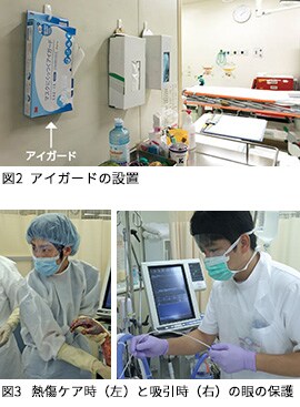 図2 アイガードの設置、図3 熱傷ケア時と吸引時の眼の保護
