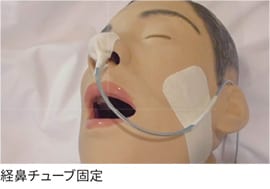 経鼻チューブ固定