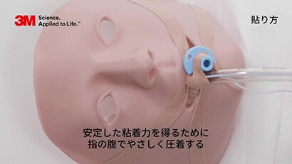 気管内チューブの固定方法
