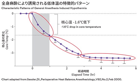 全身麻酔により誘発される低体温の特徴的パターン