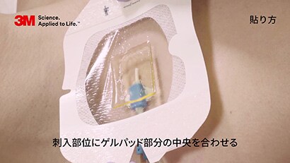 ３Ｍ™ テガダーム™ CHG ドレッシング（製品番号：1658R）の使用方法
