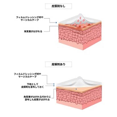 皮膜剤による対策