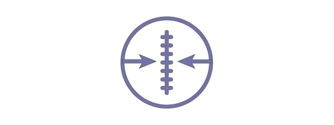 縫合糸/ステープルによる閉鎖創を保護し、外側への張力を減張※2
