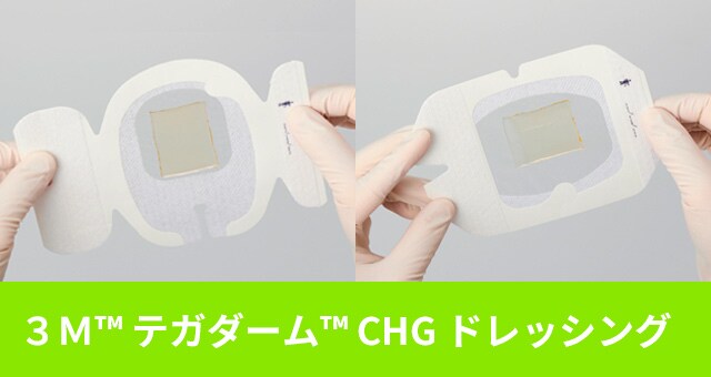 ３Ｍ™ テガダーム™ CHG ドレッシング
