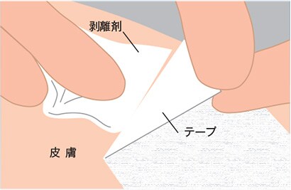 テープ剥がし方３
