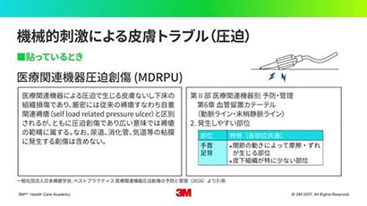 血管内留置カテーテルの管理について ② -フィルムドレッシング材の適正使用-
