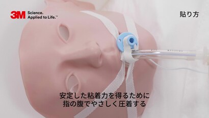 気管内チューブの固定方法２
