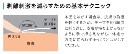 剥離刺激を減らすための基本テクニック